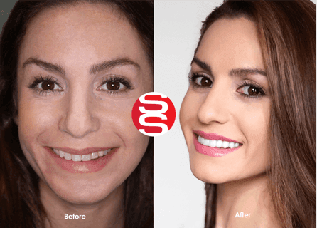 Ashley Before - After